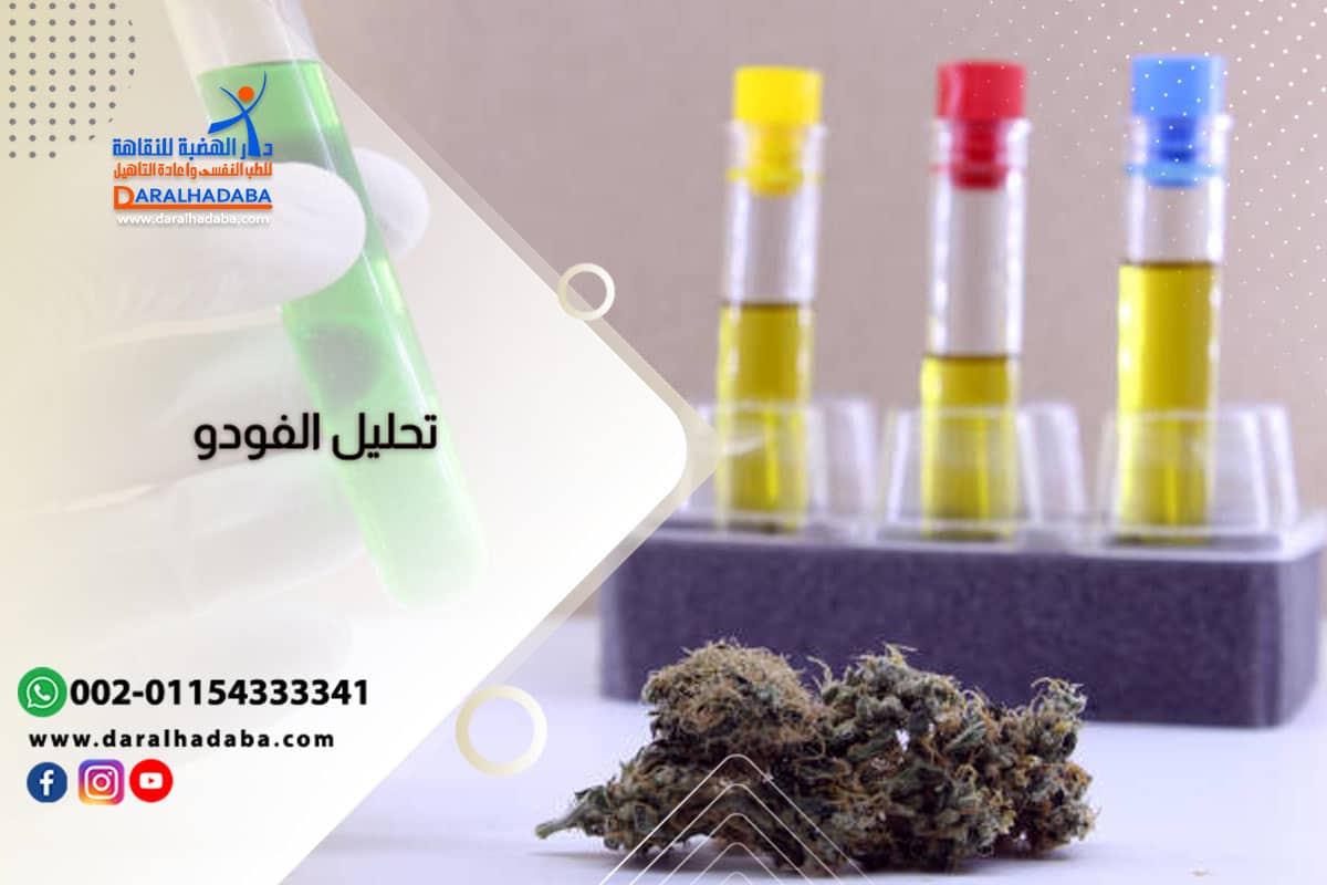 تحليل الفودو عينات لإجراء تحليل الفودو