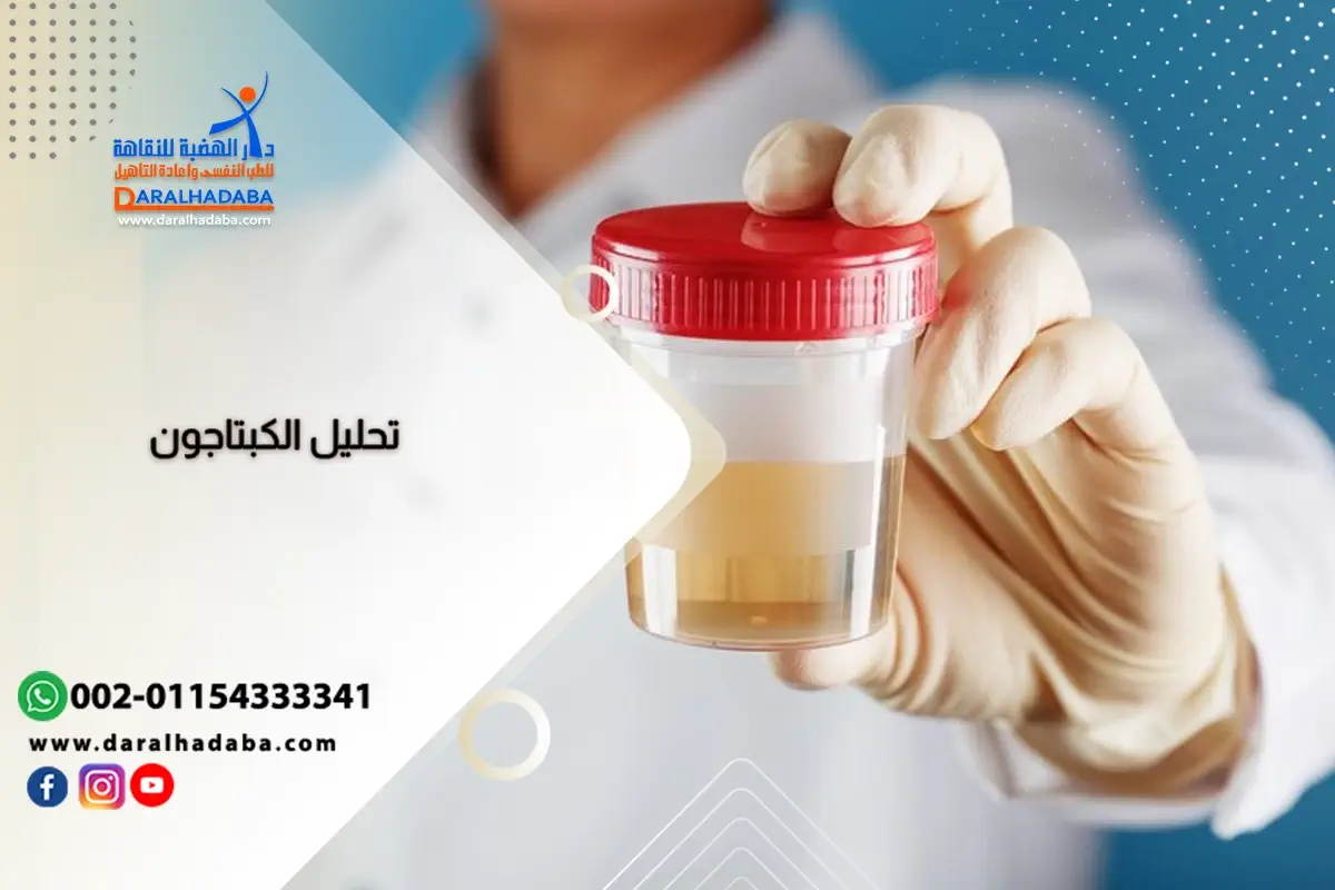 عينه بول لتحليل الكبتاجون المخدر عينه بول لتحليل الكبتاجون المخدر